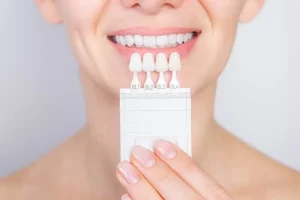 Porcelain Veneers Procedures