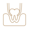 Wisdom Tooth Removal